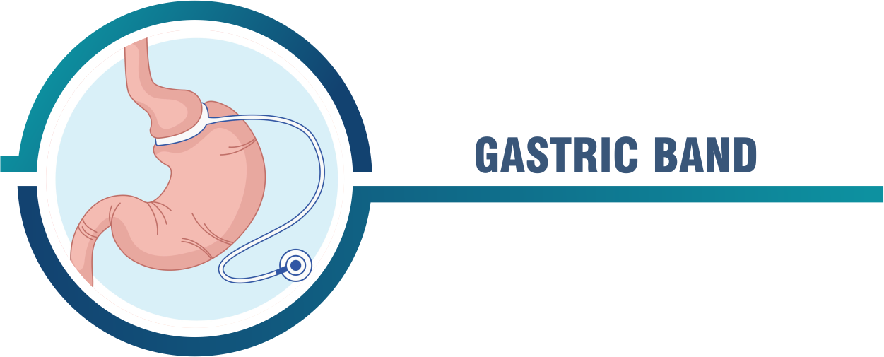 Gastric Band Global Care gastric-bypass-before-and-after-women