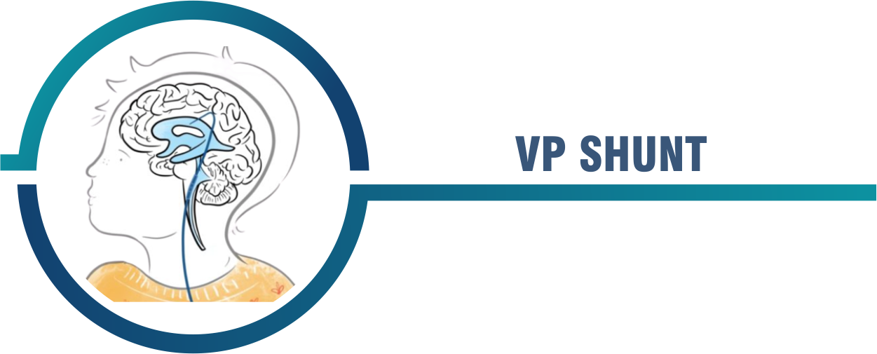 VP Shunt  Global Care